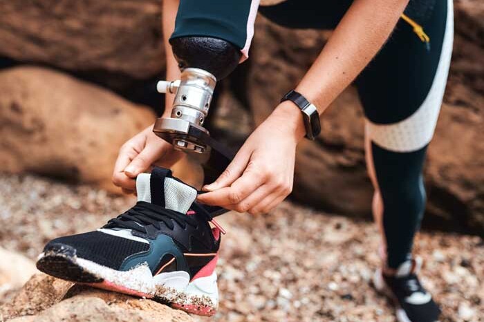 modern technology for prosthetic foot